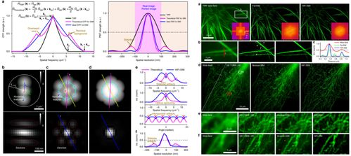 蘇州醫(yī)工所結構光照明超分辨顯微成像技術研究取得系列進展
